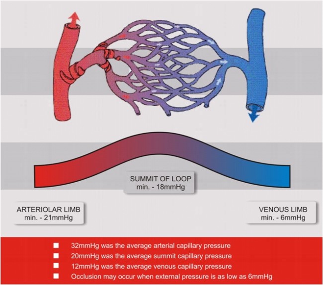 Capillary Occlusion Pressure